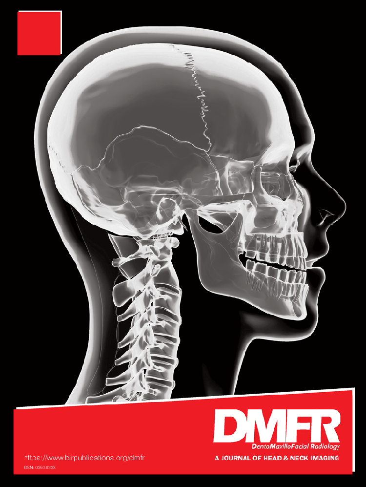 Spatial agreement of demineralized areas in quantitative light-induced fluorescence images and digital photographs